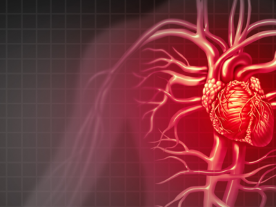 Chest Pain - St. Michael's Elite Hospital