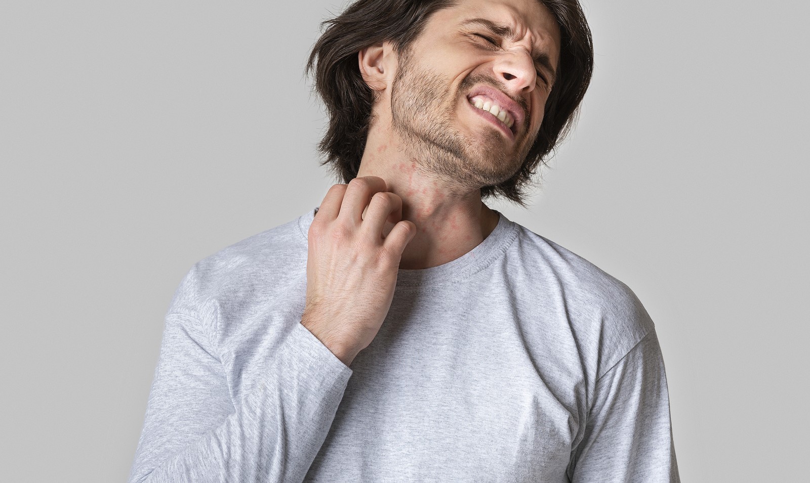 Is My Rash A Concern?