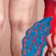 How to Know if You Have Deep Vein Thrombosis (DVT)