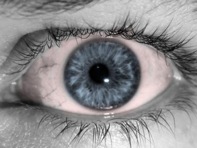 Does My Child Have Pink Eye