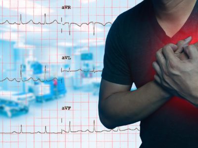Heart Disease (CVD Cardiovascular Disease)